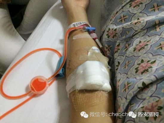 两年间母亲爷爷离世 19岁少女肿瘤晚期笑对病魔