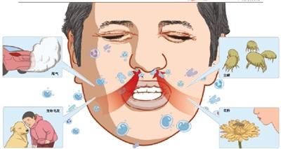 别把过敏当感冒 过敏性鼻炎的治疗和预防(图)-