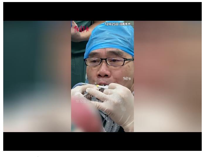 “我快坚持不住了！”医生为1岁男童吹氧，下一秒……