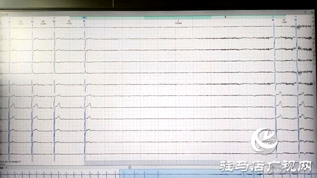 40岁中年 一夜之间心脏停搏30次最长10秒钟 该拿什么拯救他?