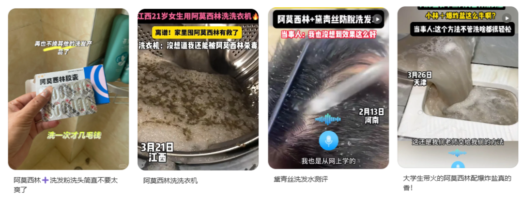 用阿莫西林洗头，能治疗脱发？别信！